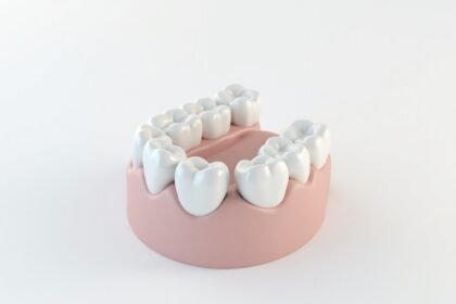 Implantate & Kronen: Was Zahnversicherungen leisten